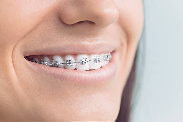 Best Tooth Extraction  in Lockhart, FL